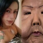 Juju do Pix Enfrenta Complicações Pós-Cirurgia de Remoção de Óleo